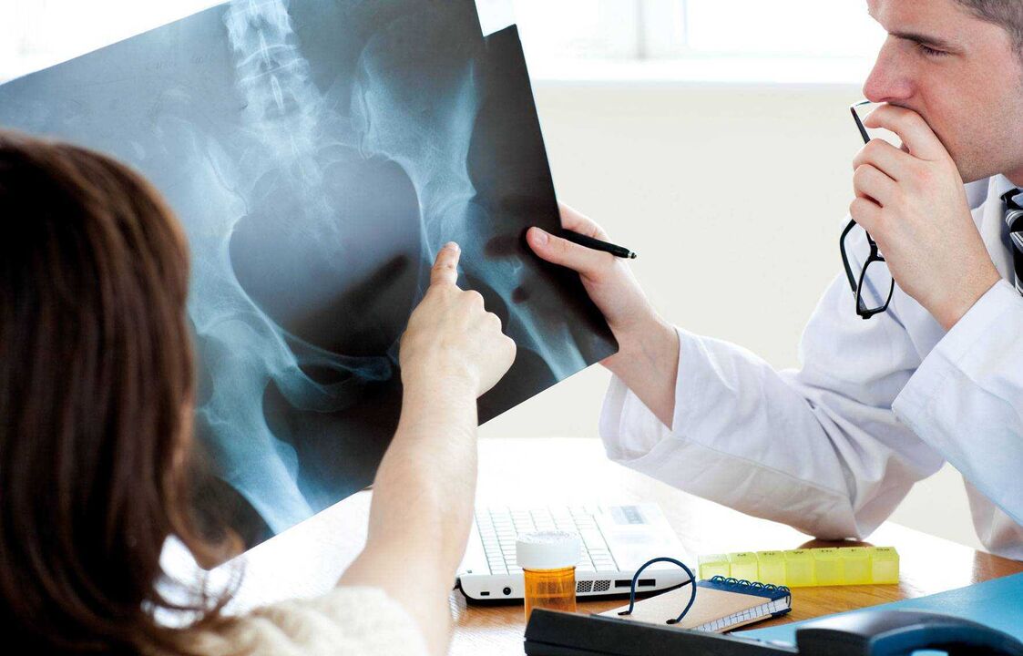 az orvosok röntgenvizsgálatot végeznek csípőízületi arthrosis miatt
